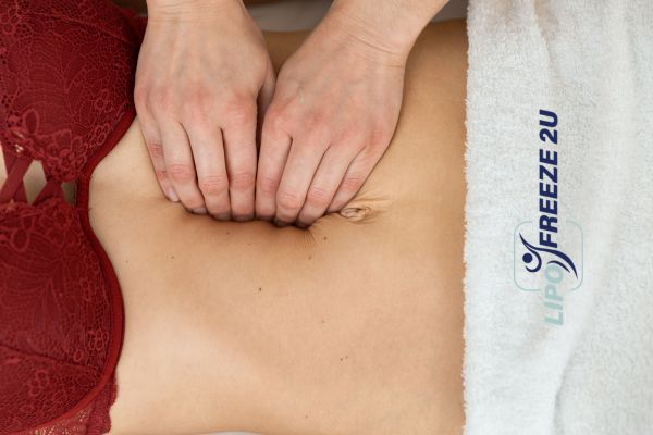 diastasis recti treatment Bury