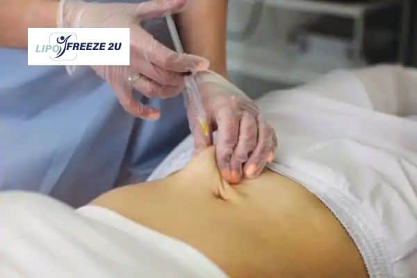 Fat Dissolving Injections Bury & Weight loss medication