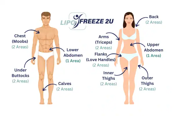 Areas you can have fat freezing treatment Bury