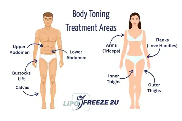 Graphic showing where you can have Body toning Treatment Bury on your body