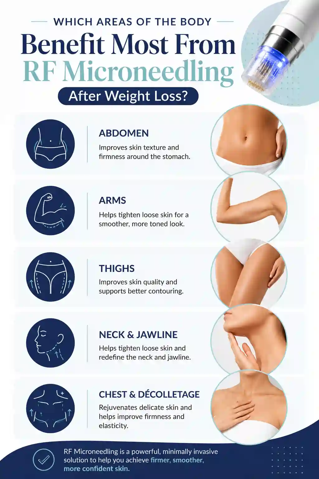 Which Areas of the Body Benefit Most From RF Microneedling After Weight Loss Bury
